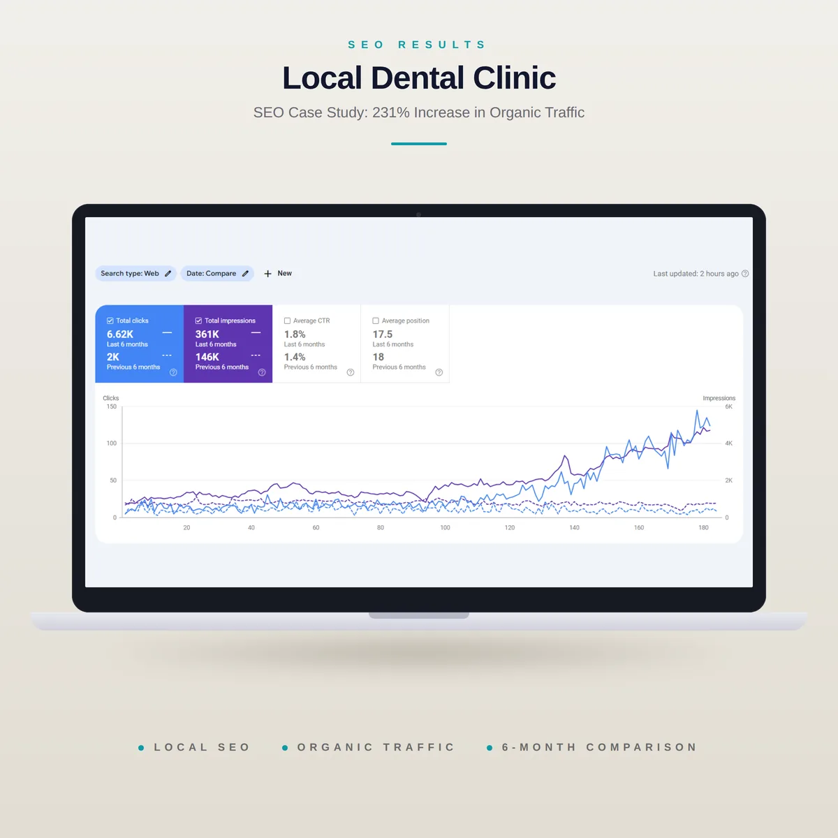 Google Search Console comparison for a local dental clinic, showing organic clicks and impressions over six months